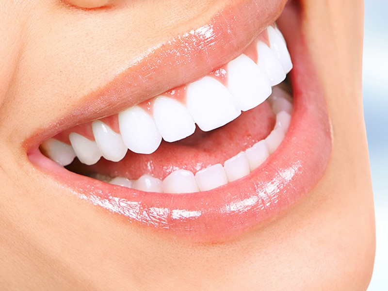 Tooth Whitening